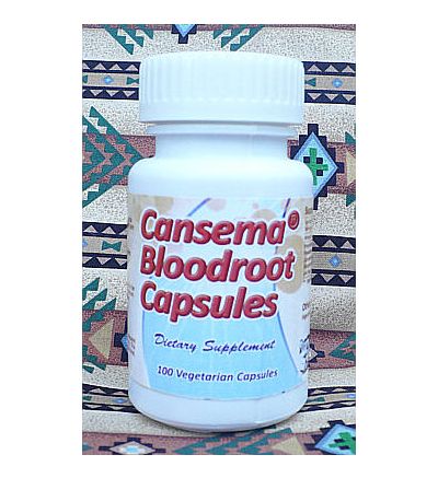 Cansema Bloodroot Capsules - 100 Vegetarian Capsules x 300mg