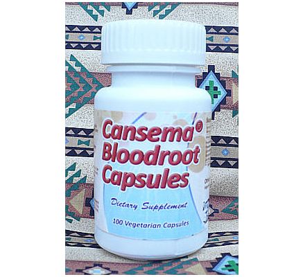 Cansema Bloodroot Capsules - 100 Vegetarian Capsules x 300mg